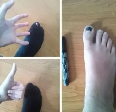 toe meme
