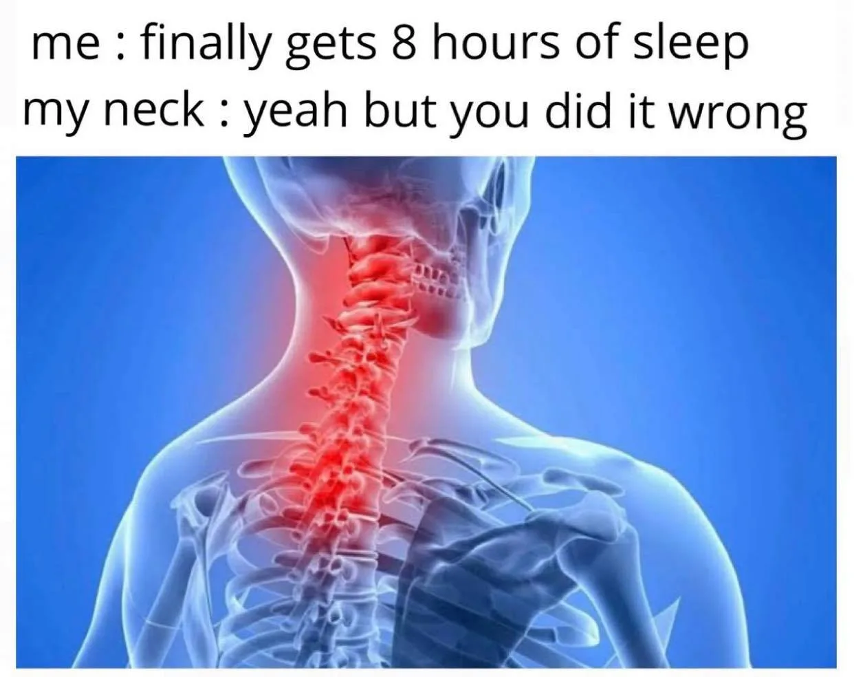 pain meme