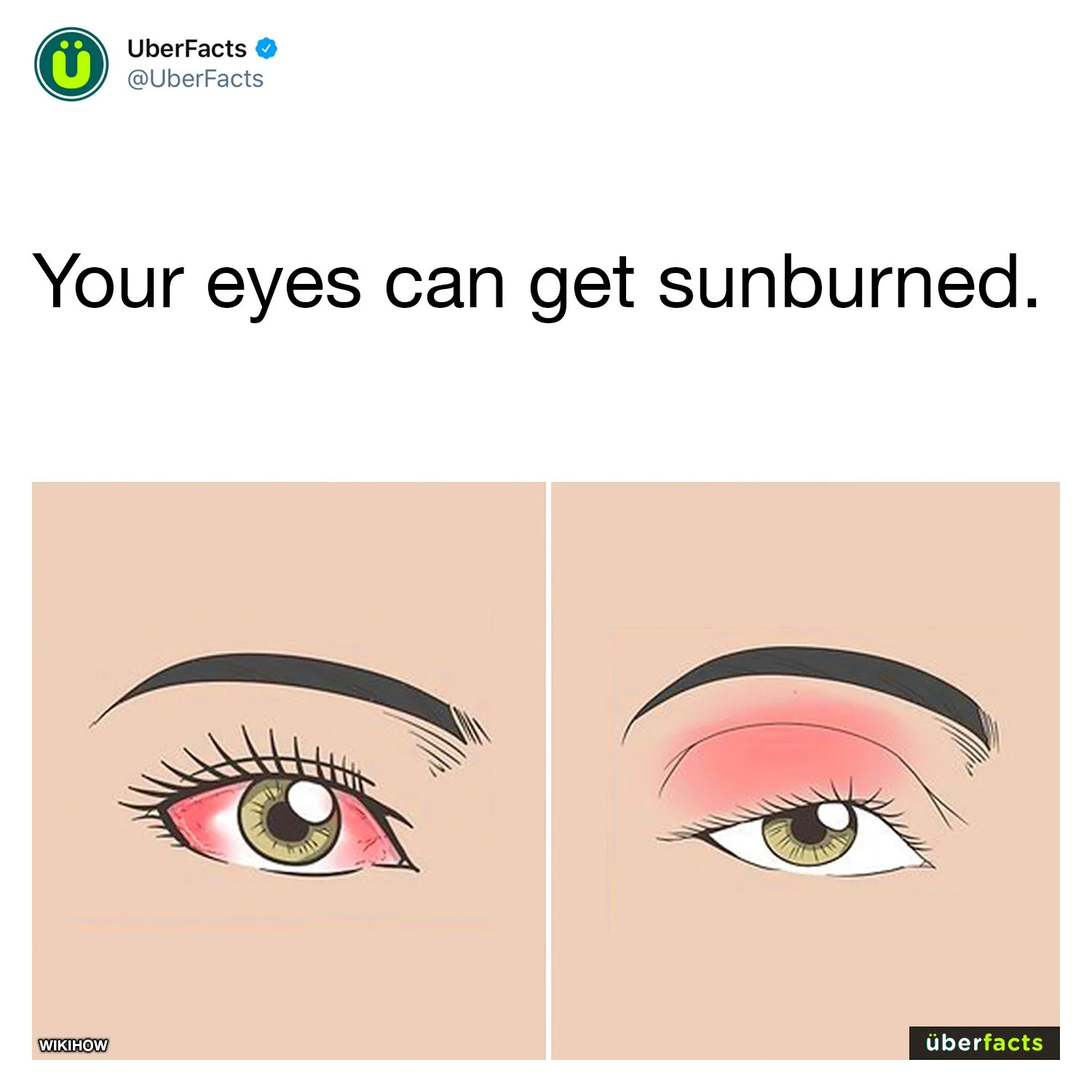 sunburn meme