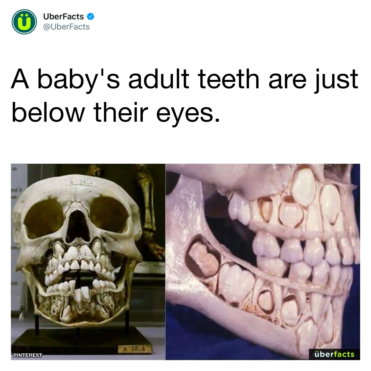 teeth meme