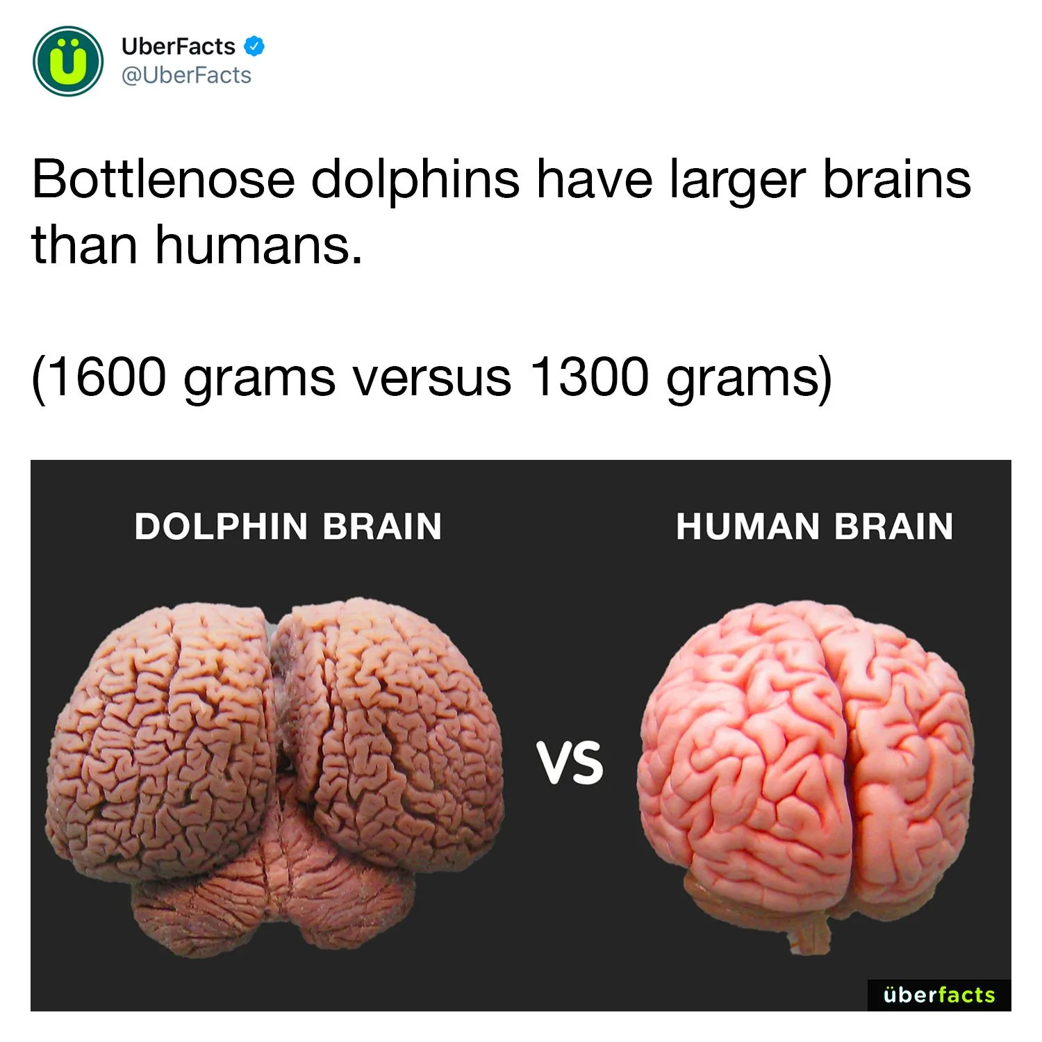 brain meme