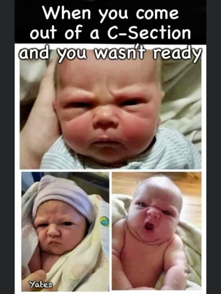 caesarean section meme