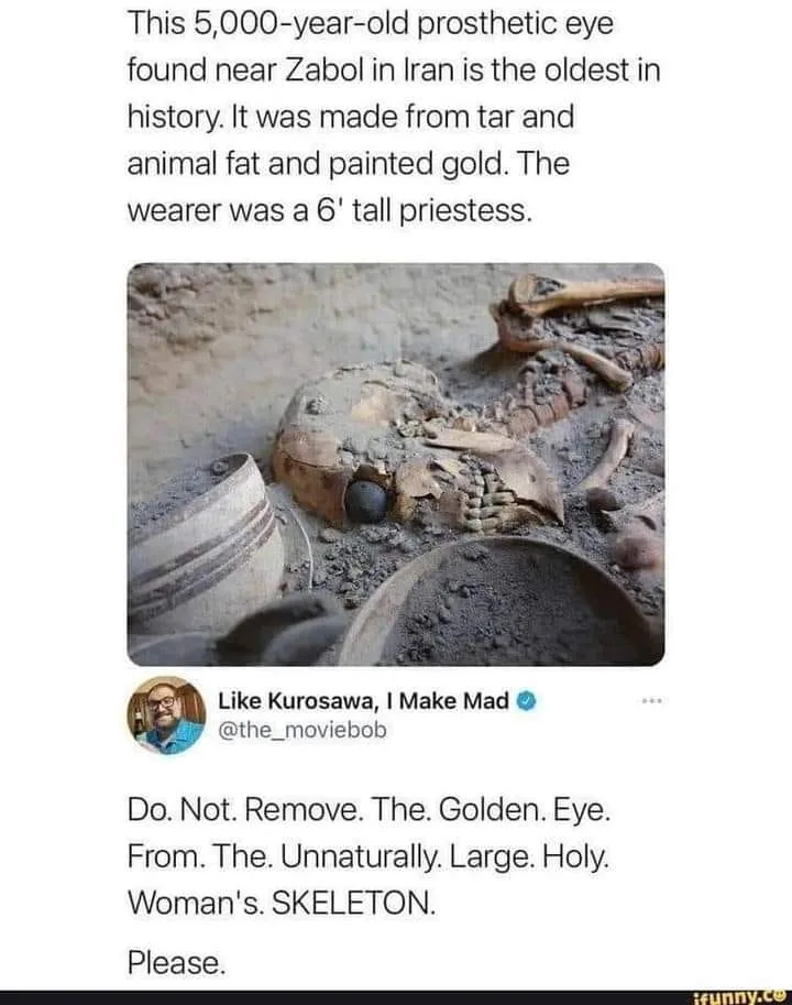 prosthesis meme