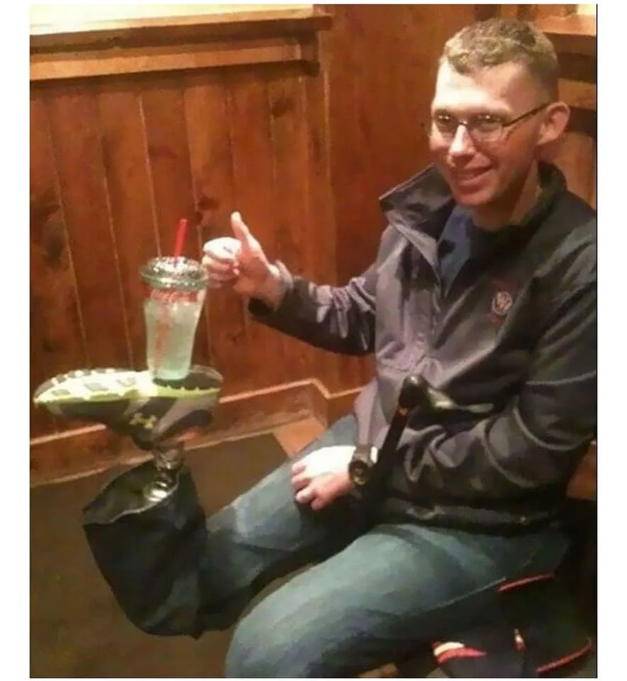 amputation meme