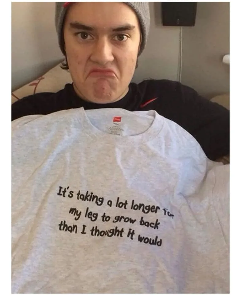 amputation meme