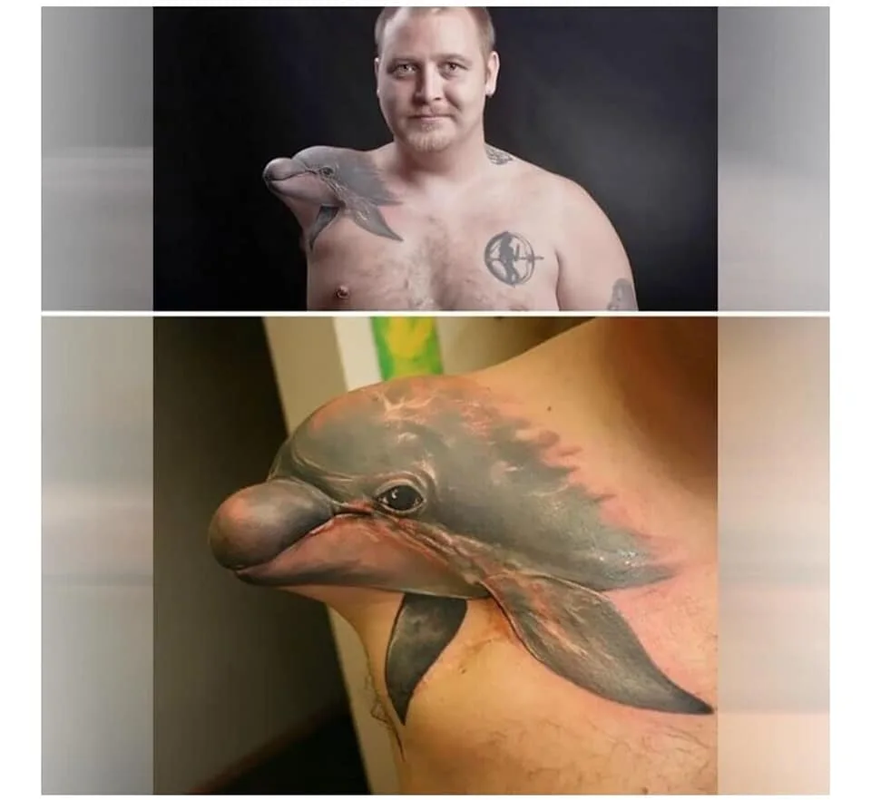 amputation meme