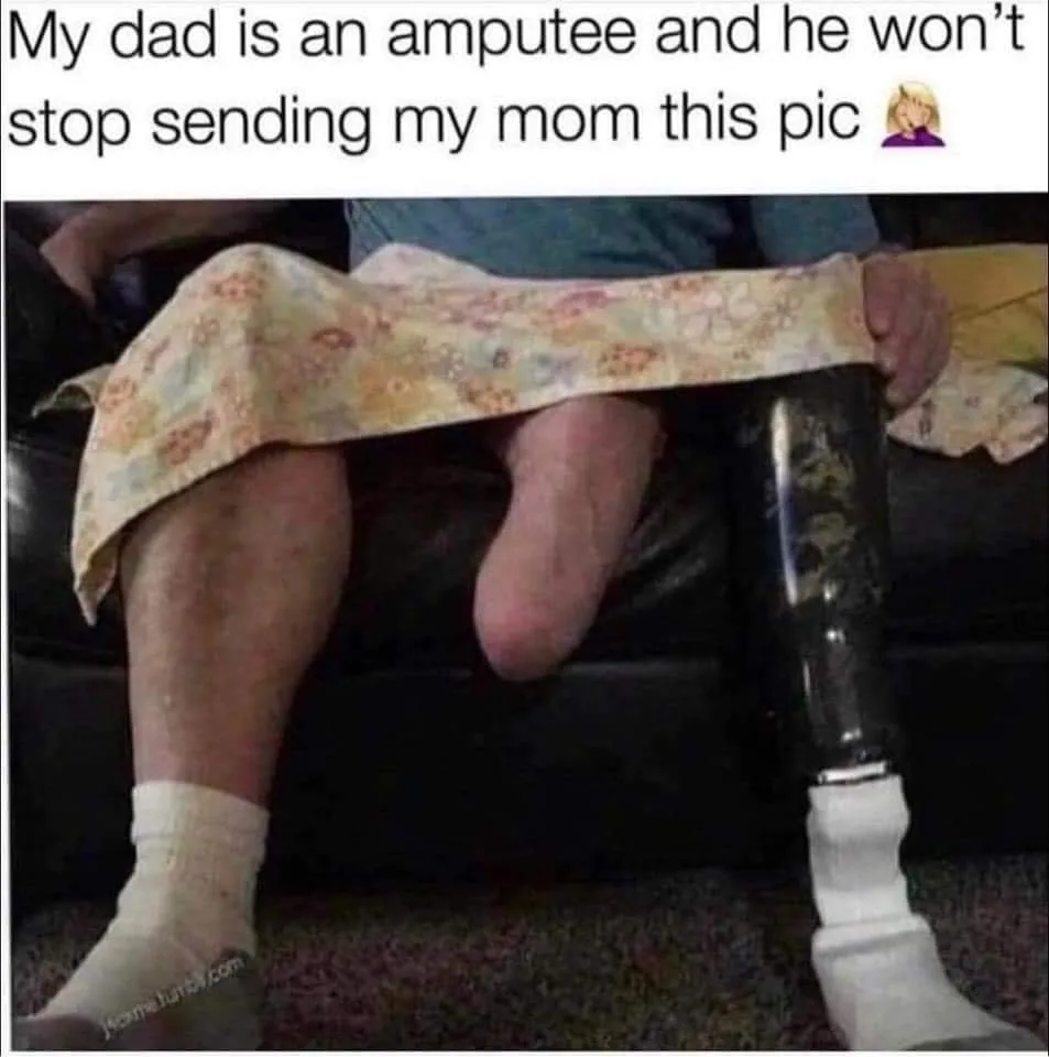 amputation meme