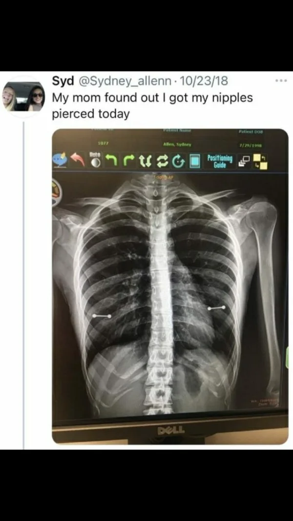 x-ray meme