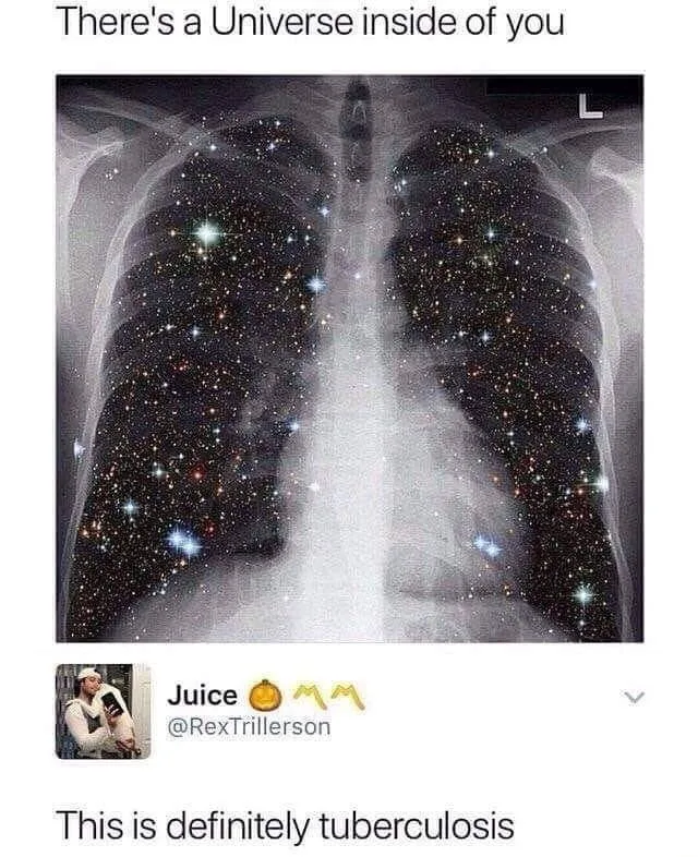 Tuberculosis meme