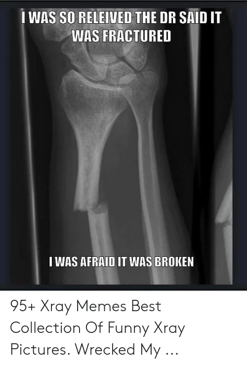 x-ray meme