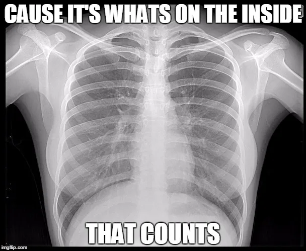x-ray meme