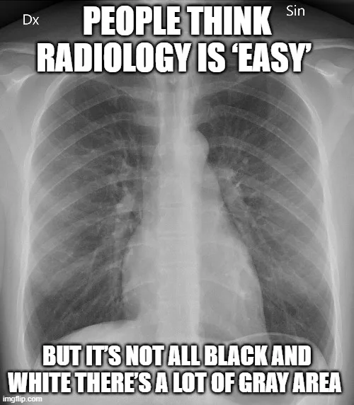 x-ray meme