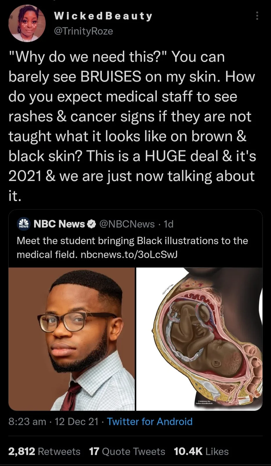 blackness meme